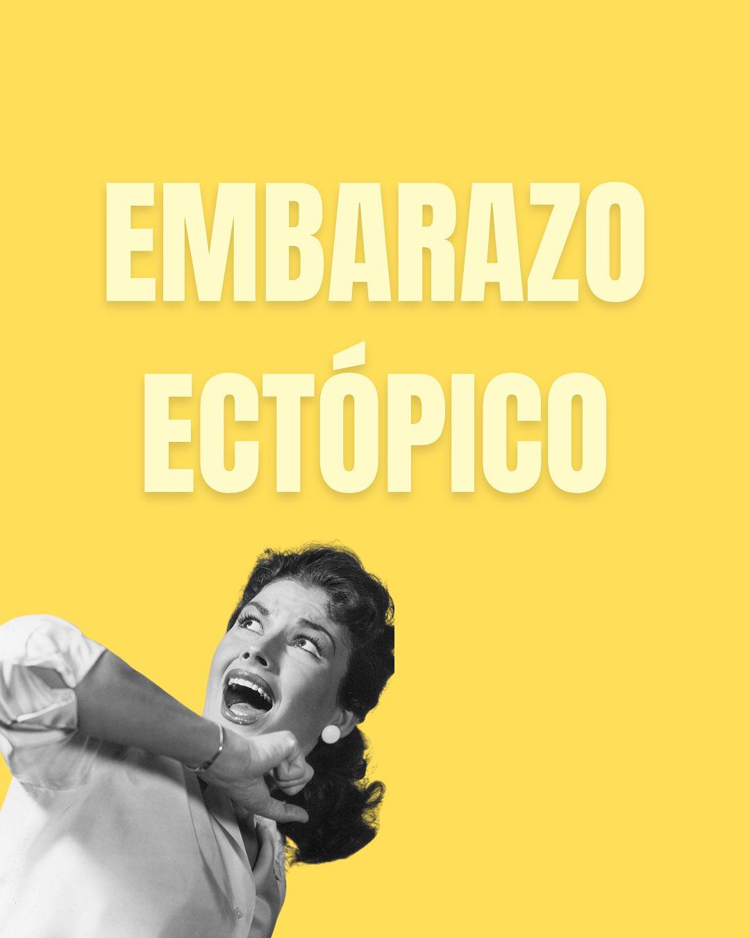 Carrusel ilustrado de Todo Bajo Contracción: Embarazo ectópico