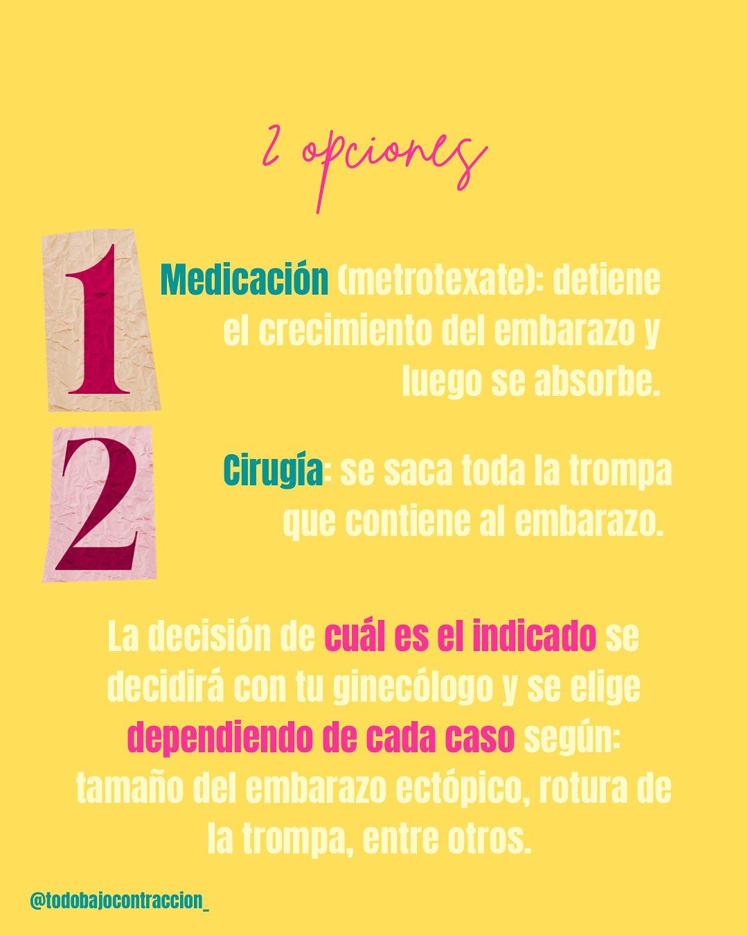 Carrusel ilustrado de Todo Bajo Contracción: Embarazo ectópico