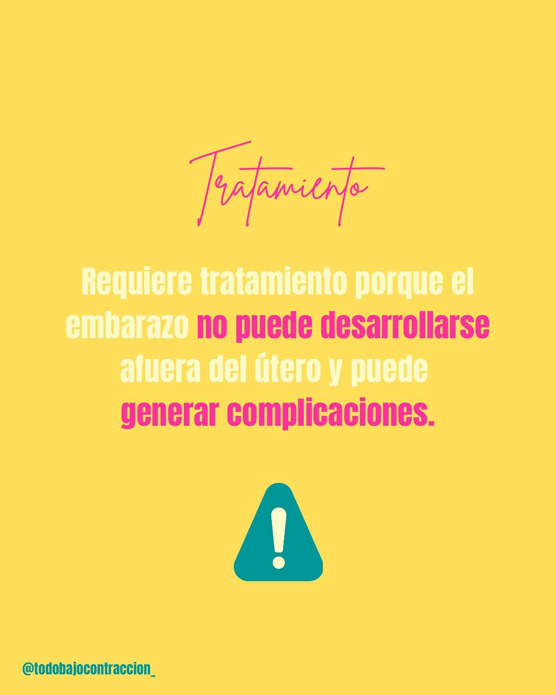 Carrusel ilustrado de Todo Bajo Contracción: Embarazo ectópico