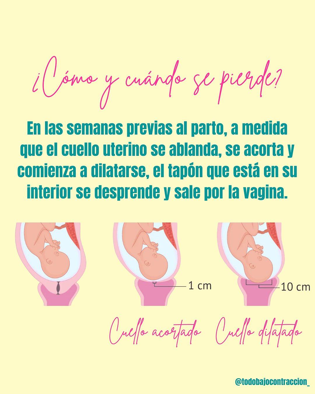 Carrusel ilustrado de Todo Bajo Contracción: Tapón mucoso: qué es y cuándo consultar