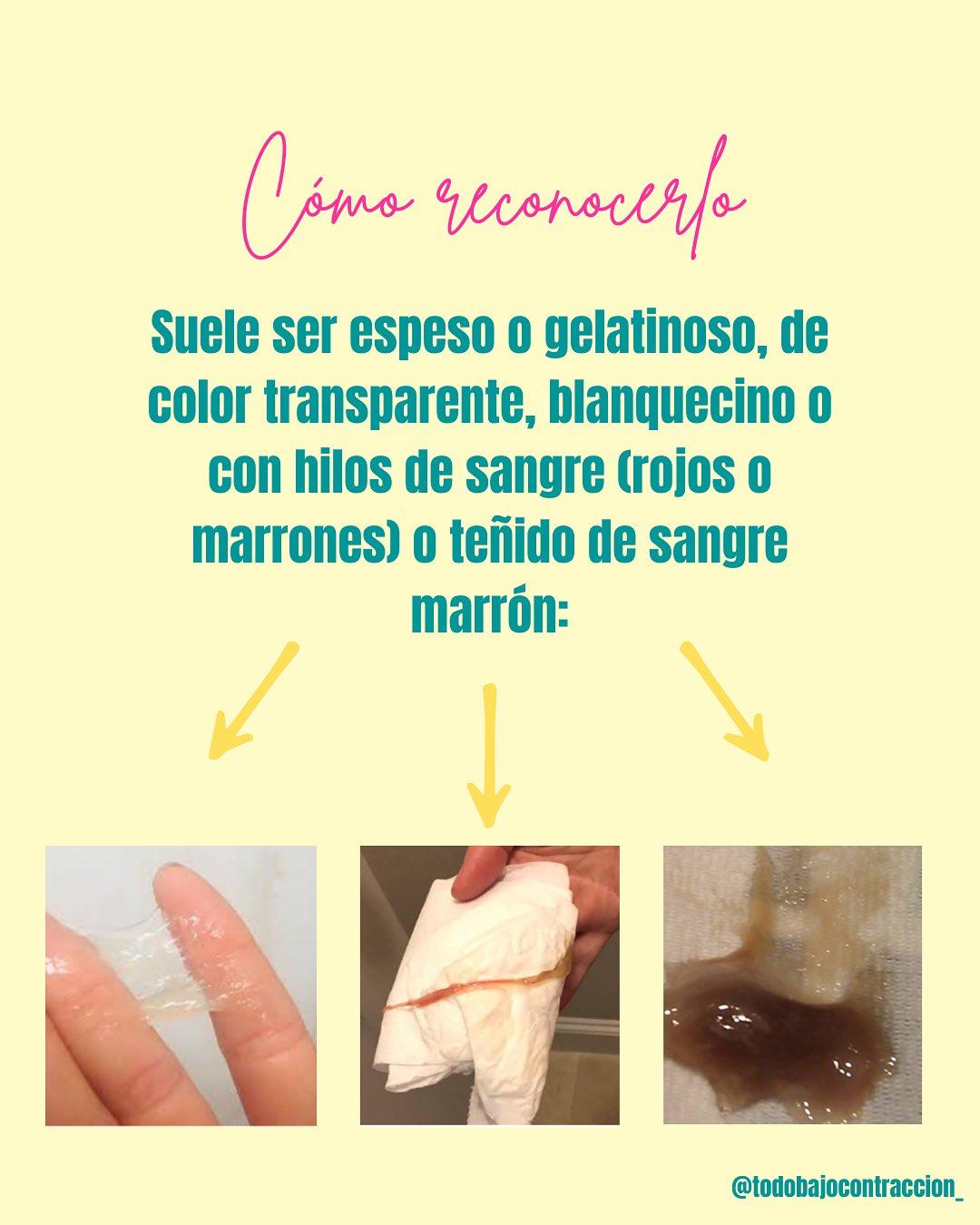 Carrusel ilustrado de Todo Bajo Contracción: Tapón mucoso: qué es y cuándo consultar