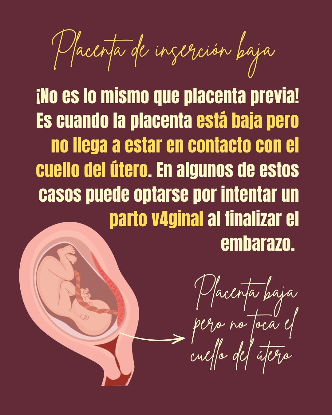 Carrusel ilustrado de Todo Bajo Contracción: Placenta previa o baja