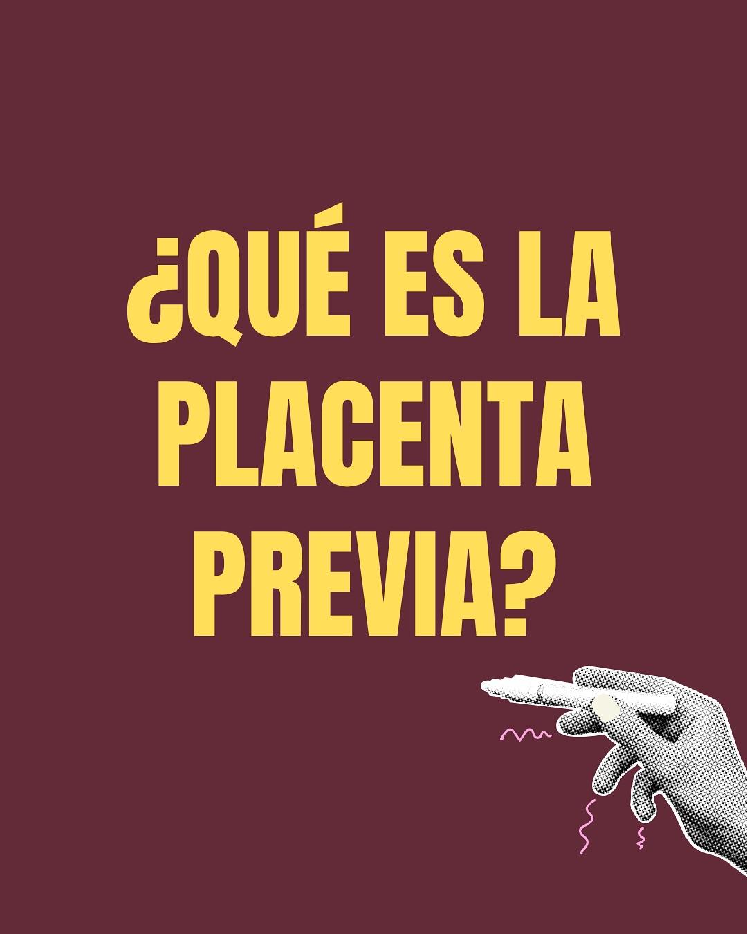 Carrusel ilustrado de Todo Bajo Contracción: Placenta previa o baja
