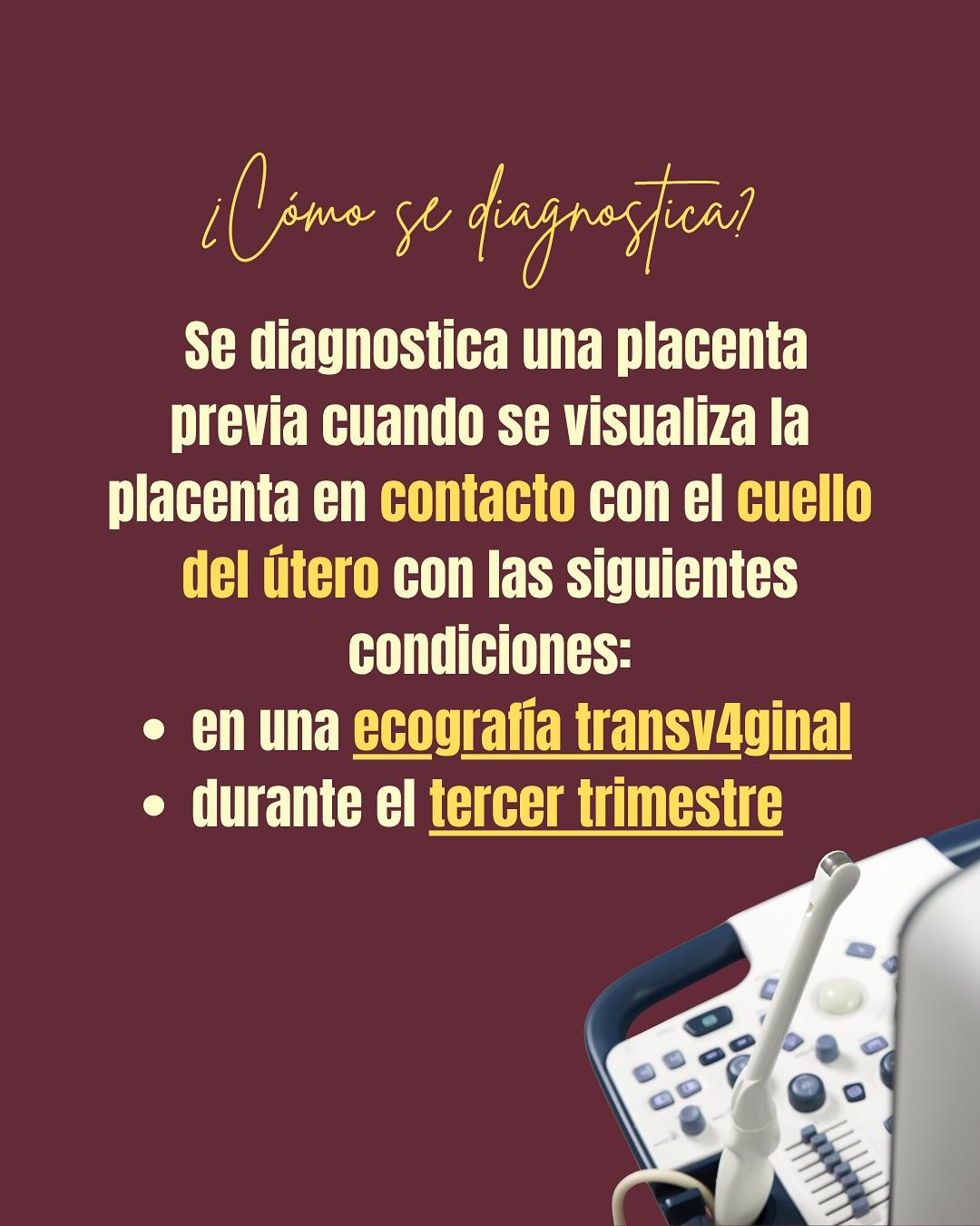 Carrusel ilustrado de Todo Bajo Contracción: Placenta previa o baja