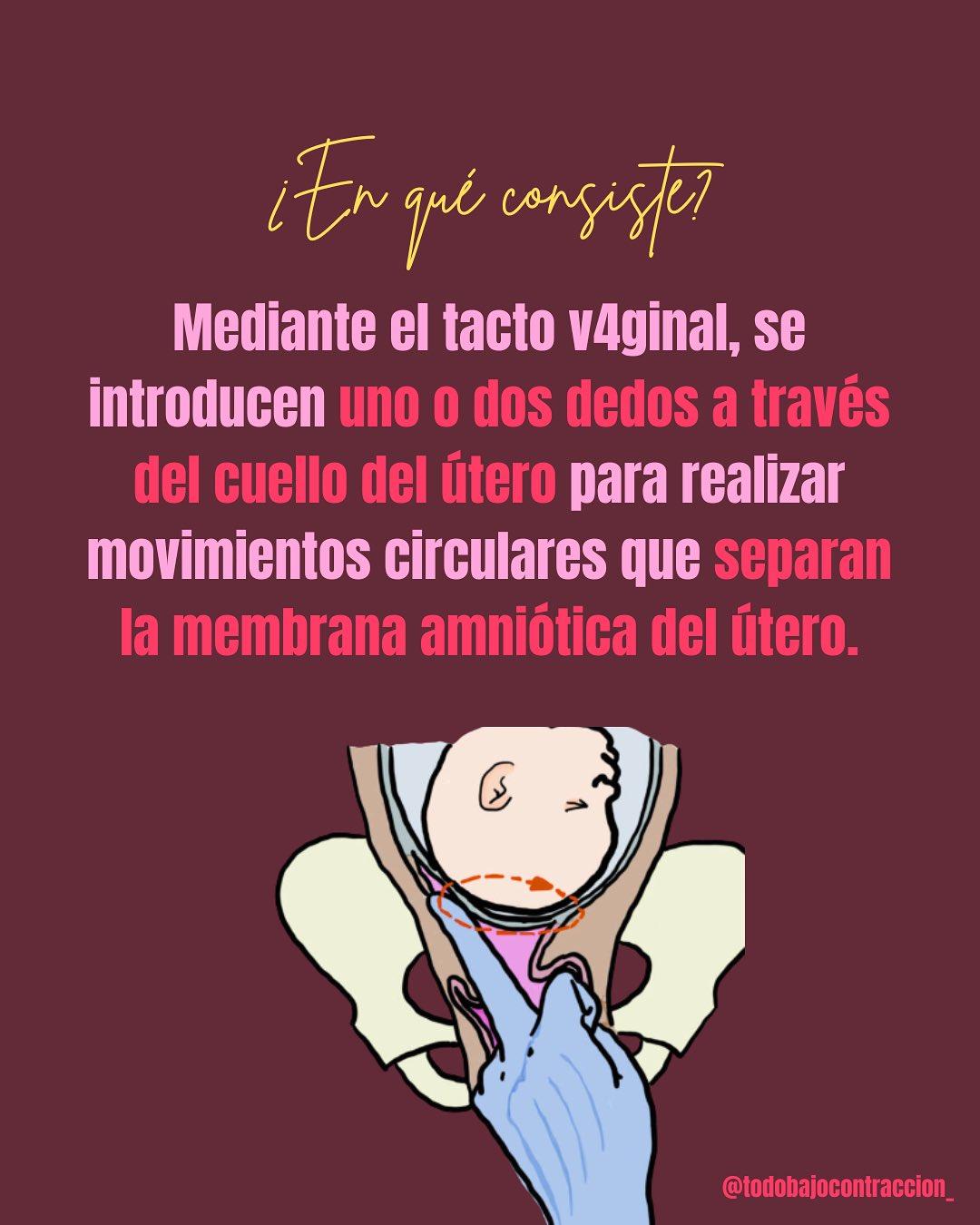 Carrusel ilustrado de Todo Bajo Contracción: Maniobra de Hamilton: qué es