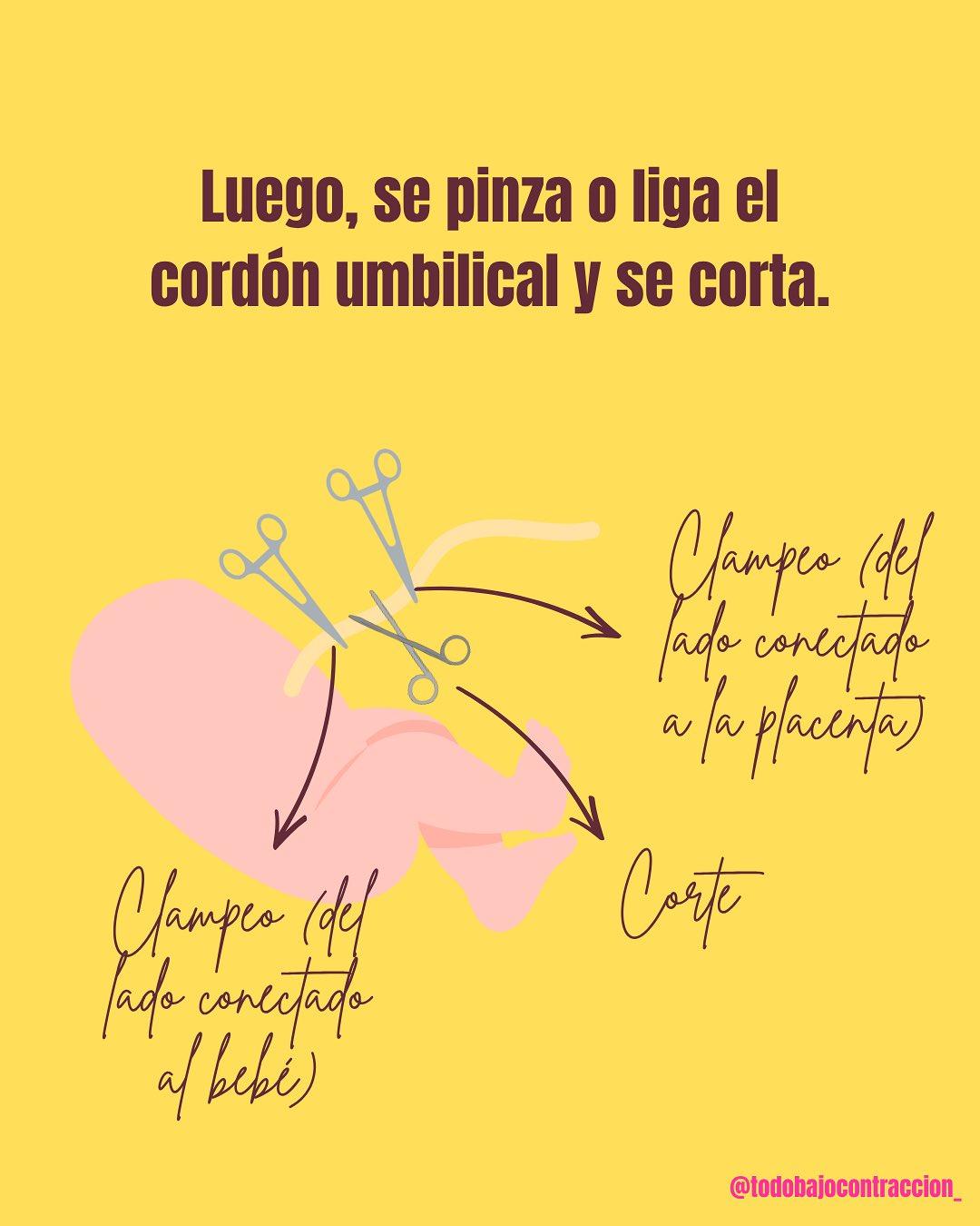 Carrusel ilustrado de Todo Bajo Contracción: Corte del cordón umbilical: ¿cuándo?