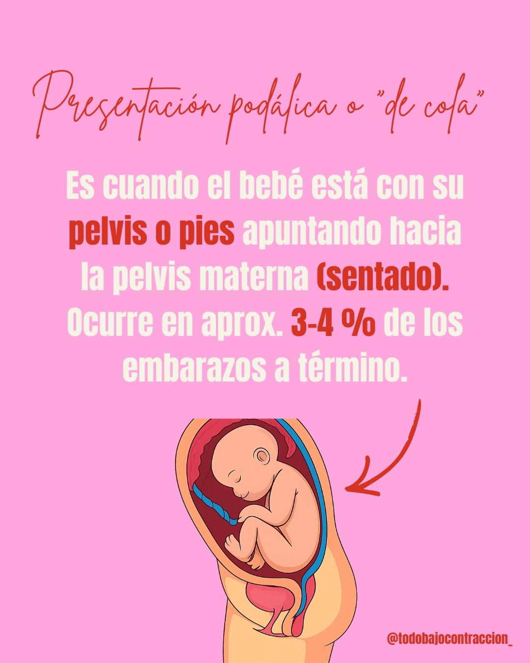 Carrusel ilustrado de Todo Bajo Contracción: Bebé en podálica: ¿siempre cesárea?