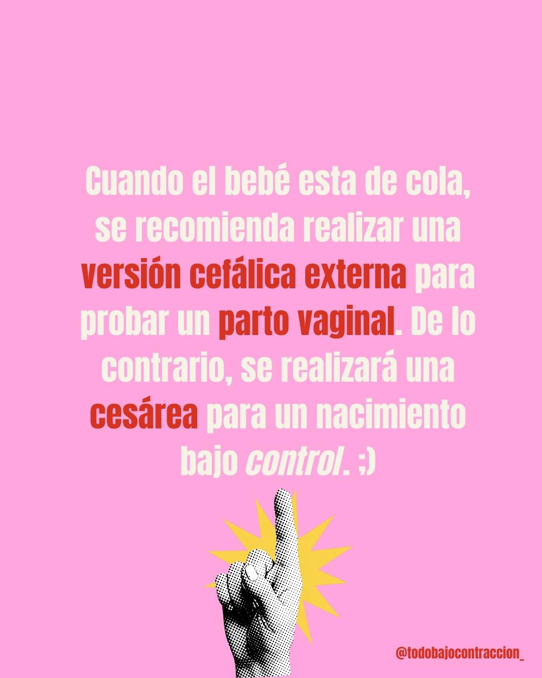 Carrusel ilustrado de Todo Bajo Contracción: Bebé en podálica: ¿siempre cesárea?