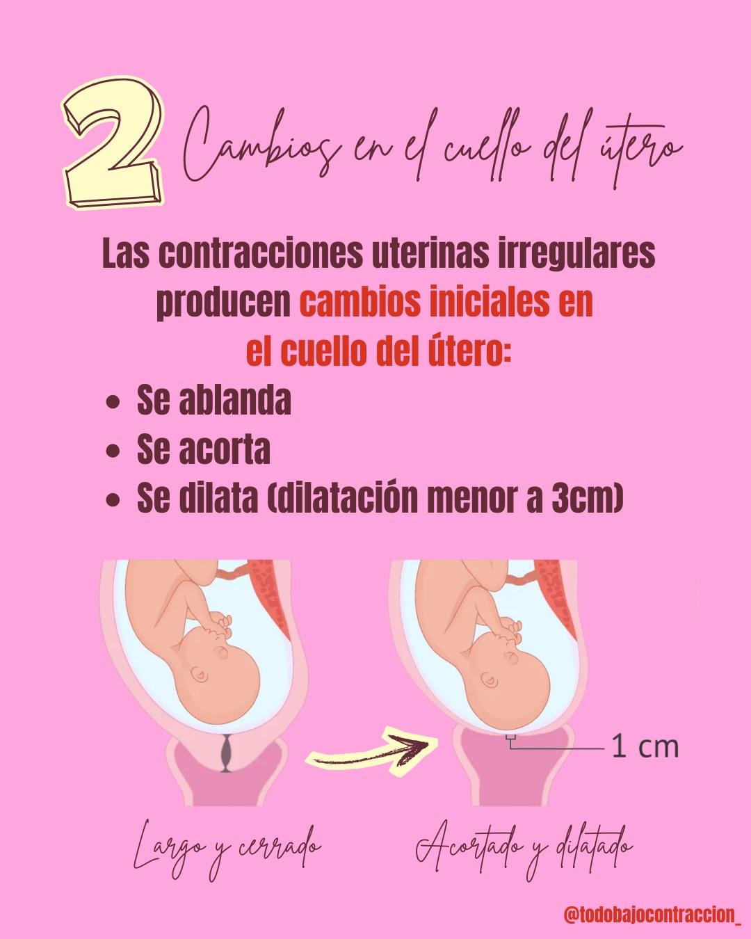 Carrusel ilustrado de Todo Bajo Contracción: Preparto: qué es y cómo transitarlo