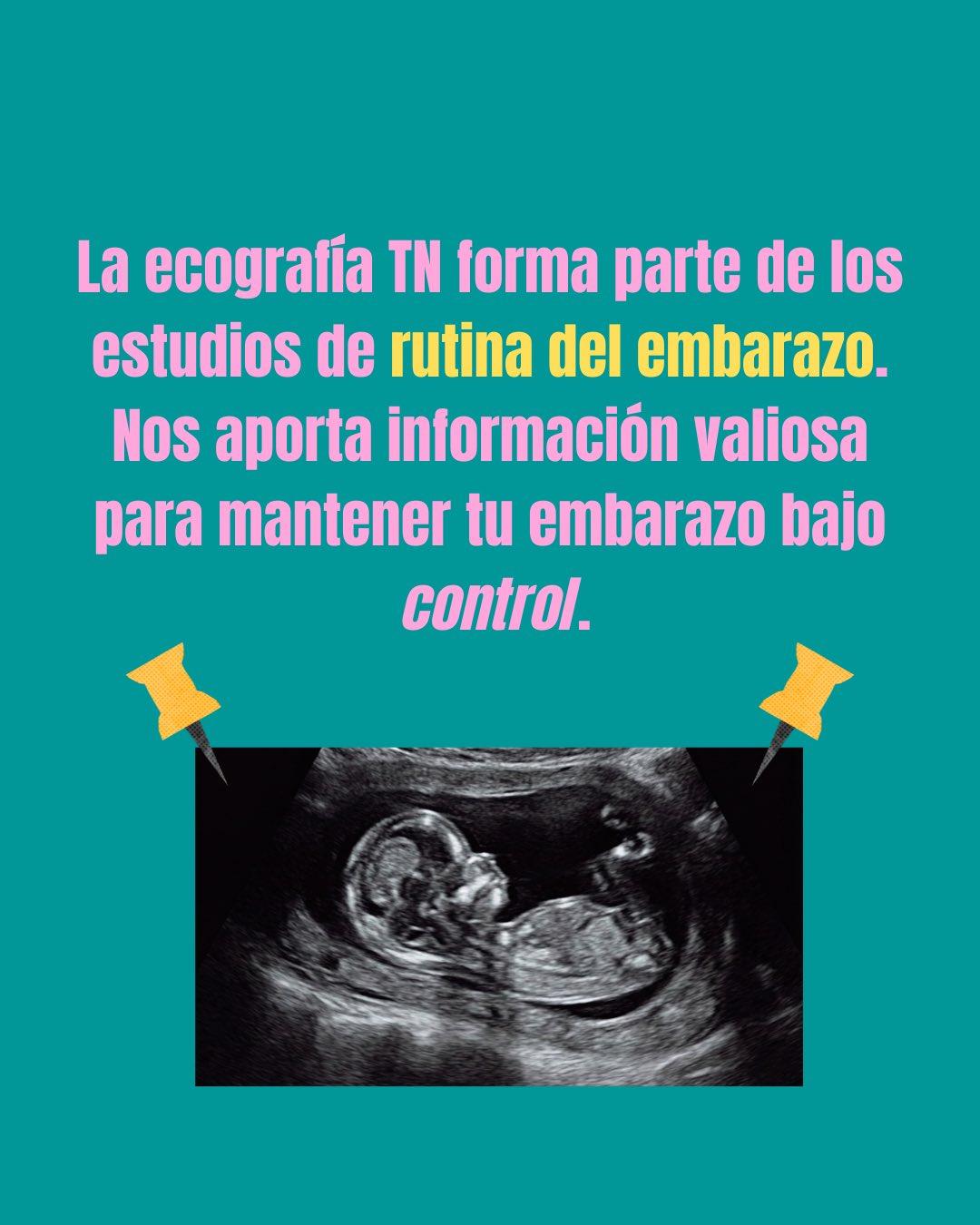 Carrusel ilustrado de Todo Bajo Contracción: Ecografía de translucencia nucal (11-14 semanas)