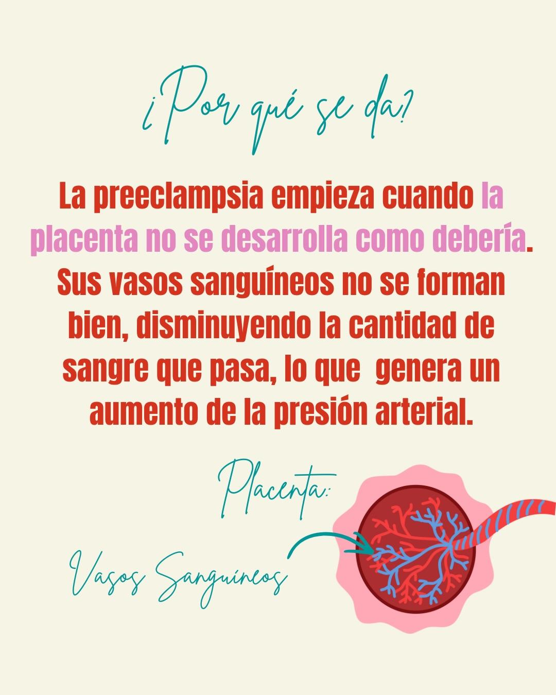 Carrusel ilustrado de Todo Bajo Contracción: Preeclampsia: qué es y cómo detectarla
