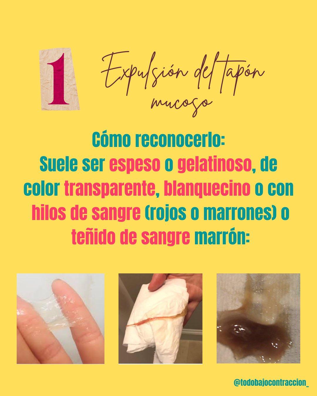 Carrusel ilustrado de Todo Bajo Contracción: Señales de que se acerca el parto