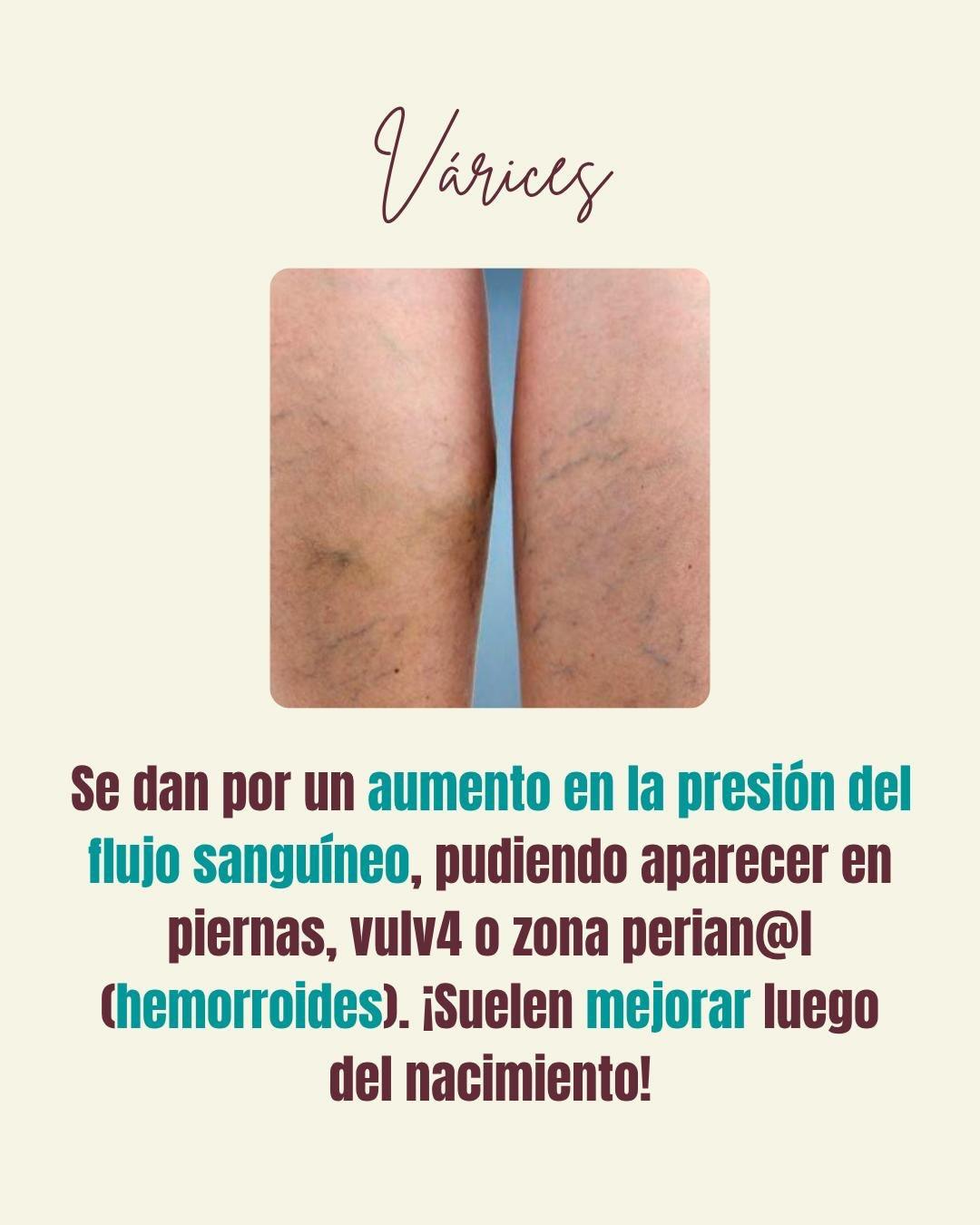 Carrusel ilustrado de Todo Bajo Contracción: Cambios en la piel durante el embarazo