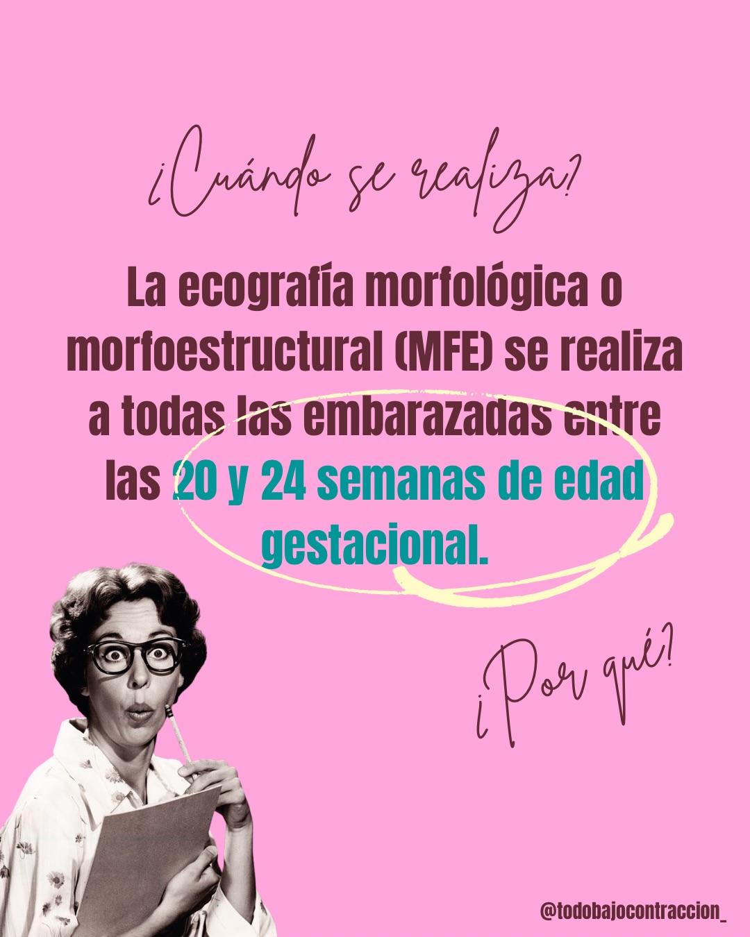 Carrusel ilustrado de Todo Bajo Contracción: Ecografía morfoestructural: qué evalúa