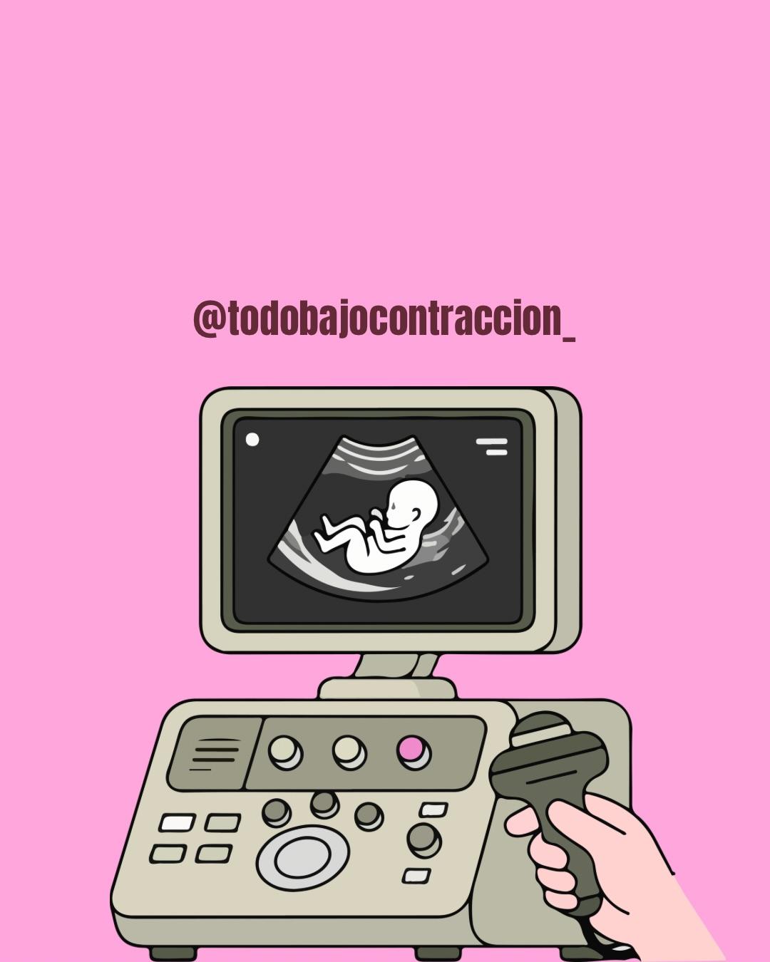Carrusel ilustrado de Todo Bajo Contracción: Ecografía morfoestructural: qué evalúa