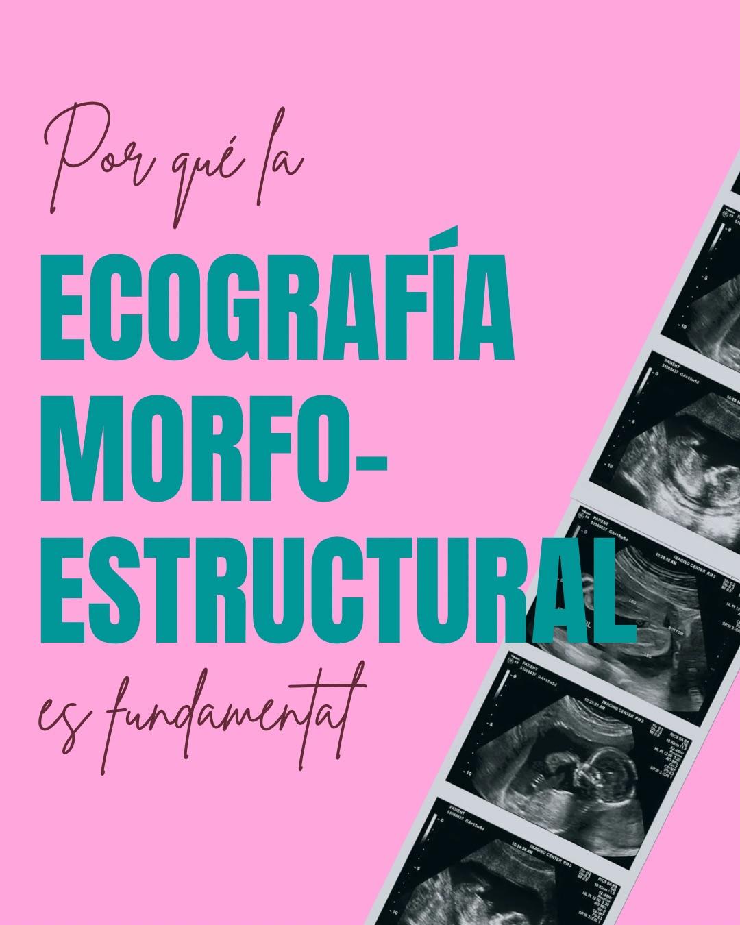Carrusel ilustrado de Todo Bajo Contracción: Ecografía morfoestructural: qué evalúa