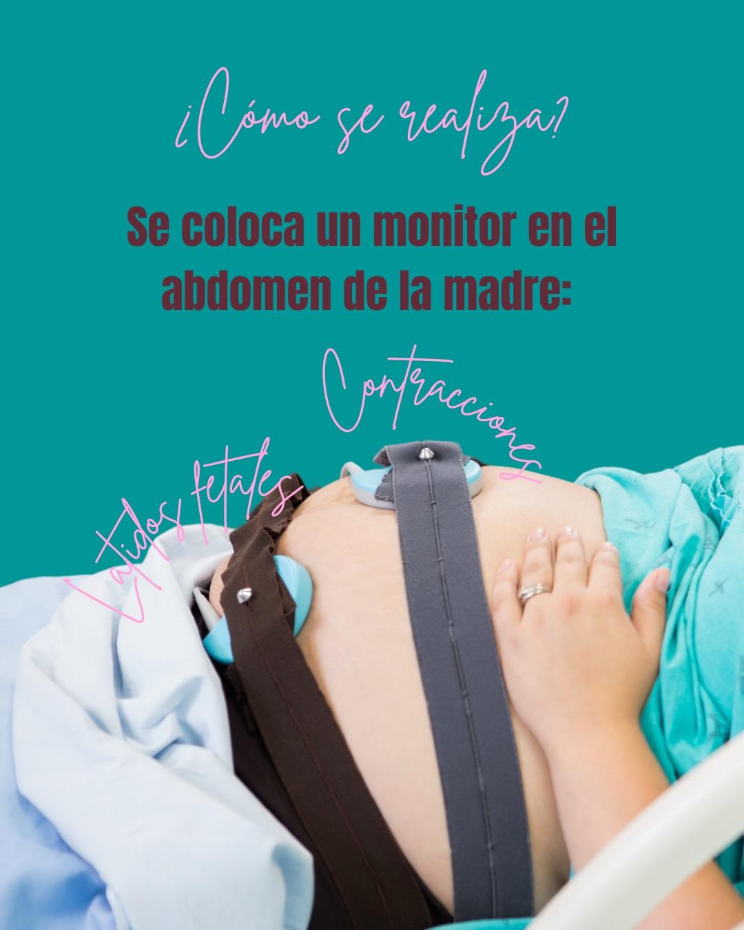 Carrusel ilustrado de Todo Bajo Contracción: Monitoreo fetal: qué es y cuándo se hace