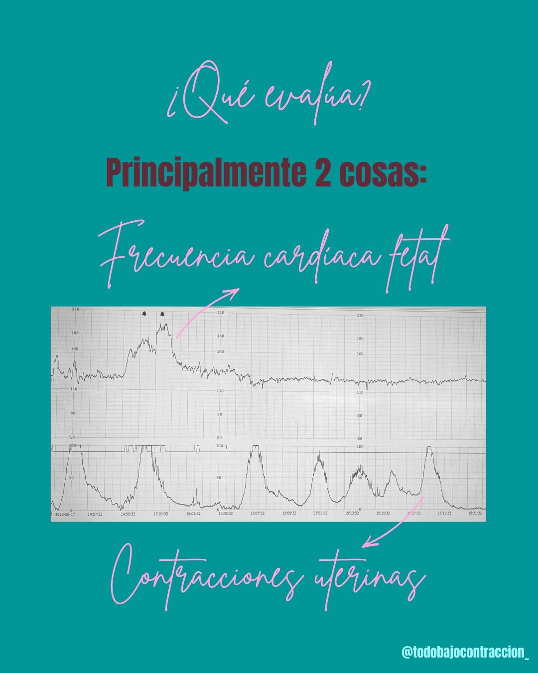 Carrusel ilustrado de Todo Bajo Contracción: Monitoreo fetal: qué es y cuándo se hace