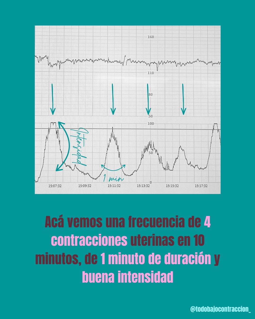 Carrusel ilustrado de Todo Bajo Contracción: Monitoreo fetal: qué es y cuándo se hace