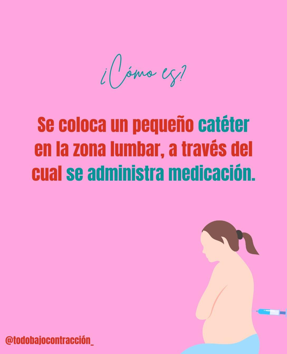 Carrusel ilustrado de Todo Bajo Contracción: Cómo aliviar el dolor en el trabajo de parto