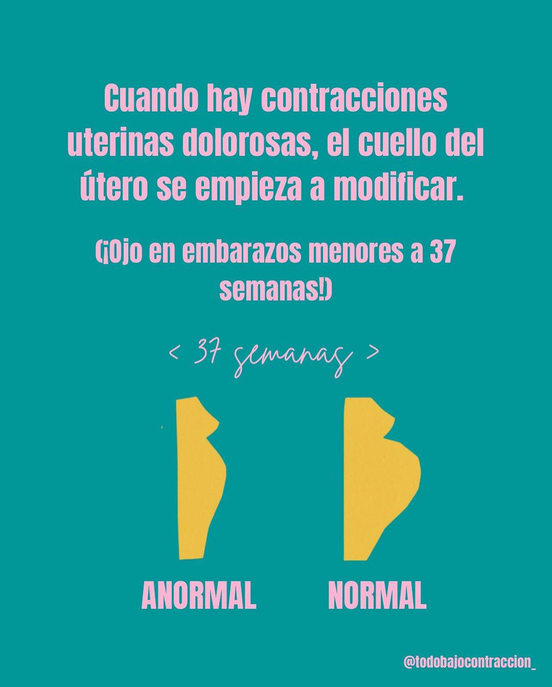 Carrusel ilustrado de Todo Bajo Contracción: Dilatación en el trabajo de parto