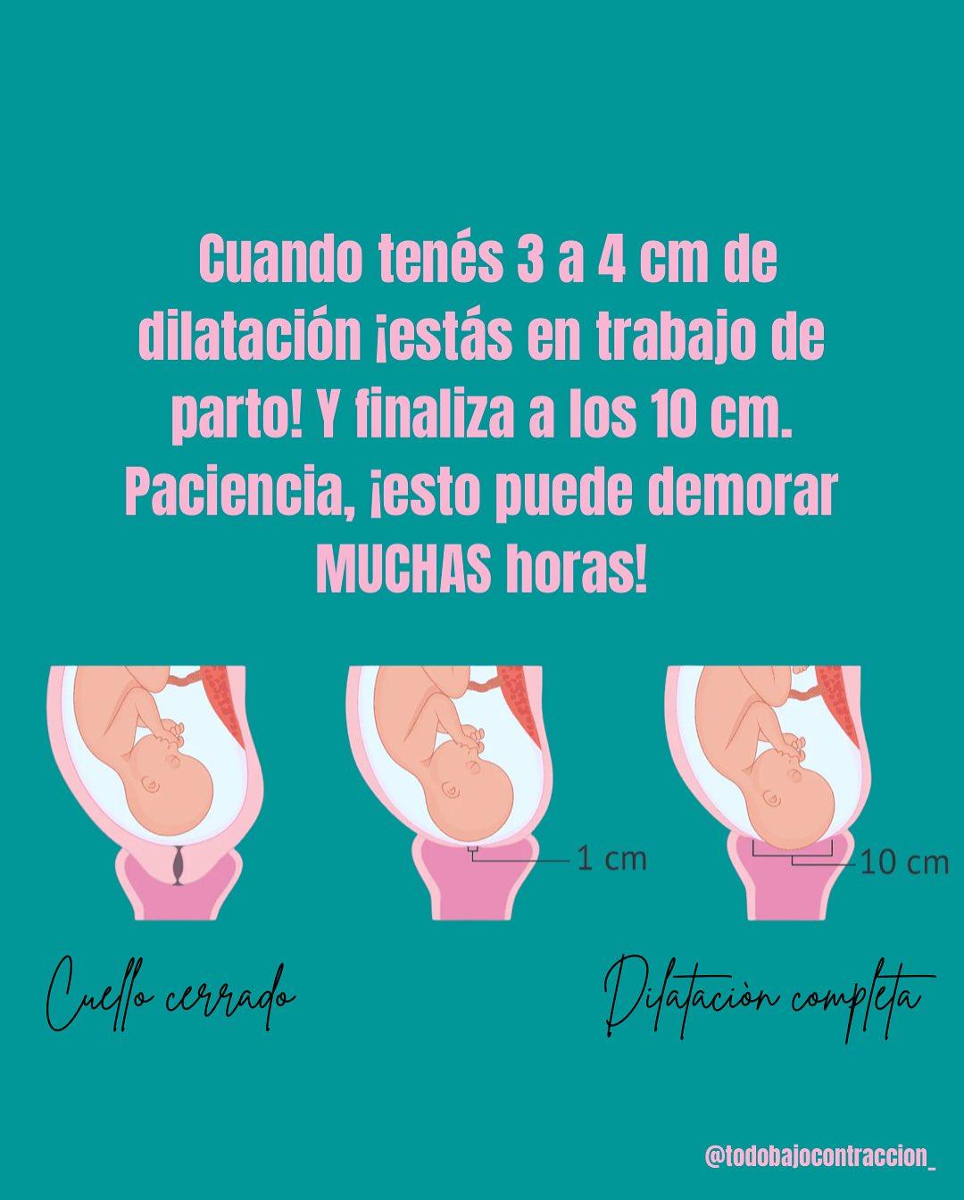 Carrusel ilustrado de Todo Bajo Contracción: Dilatación en el trabajo de parto
