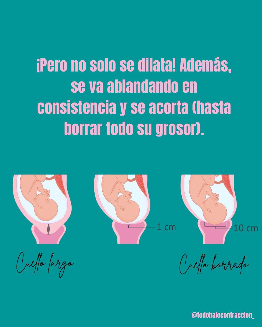 Carrusel ilustrado de Todo Bajo Contracción: Dilatación en el trabajo de parto