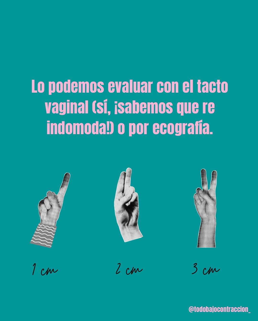 Carrusel ilustrado de Todo Bajo Contracción: Dilatación en el trabajo de parto