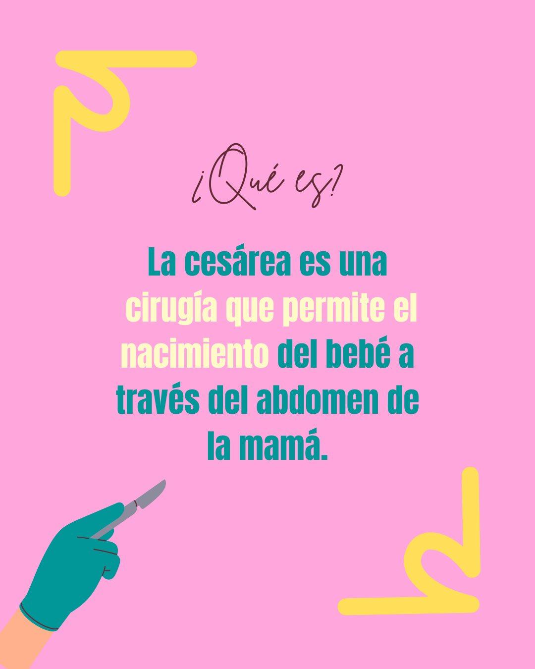 Carrusel ilustrado de Todo Bajo Contracción: Cesárea: cuándo está indicada