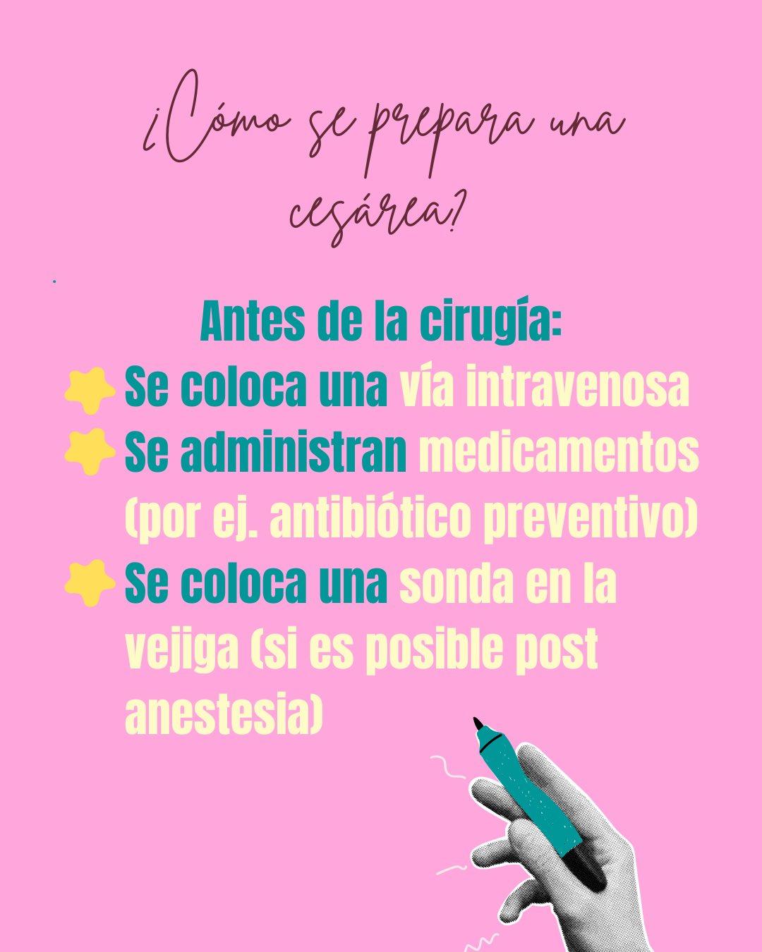 Carrusel ilustrado de Todo Bajo Contracción: Cesárea: cuándo está indicada