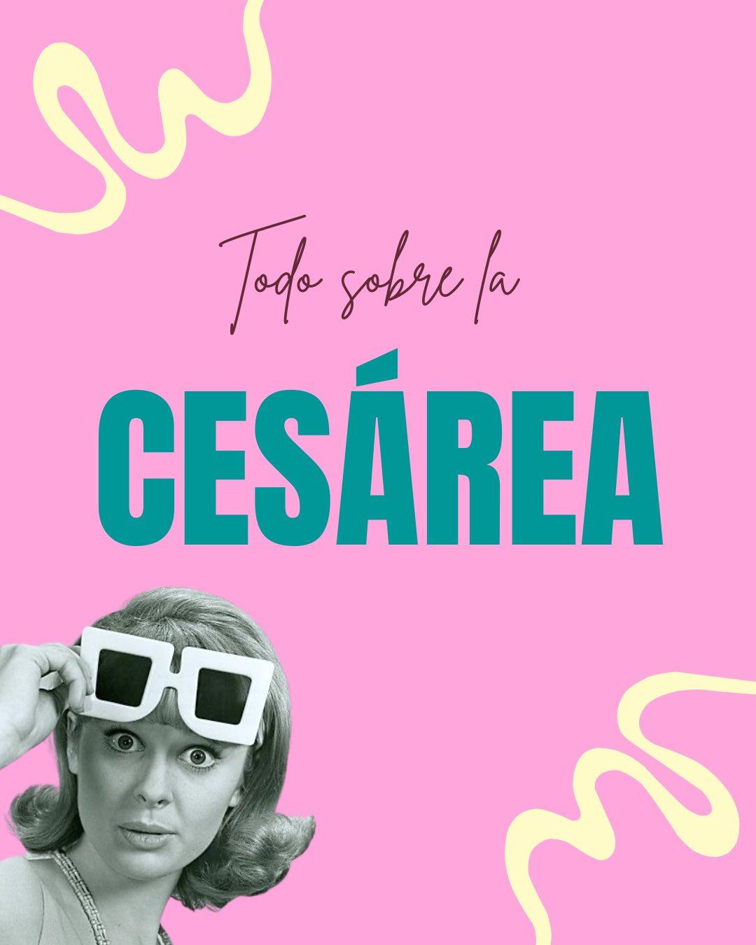 Carrusel ilustrado de Todo Bajo Contracción: Cesárea: cuándo está indicada