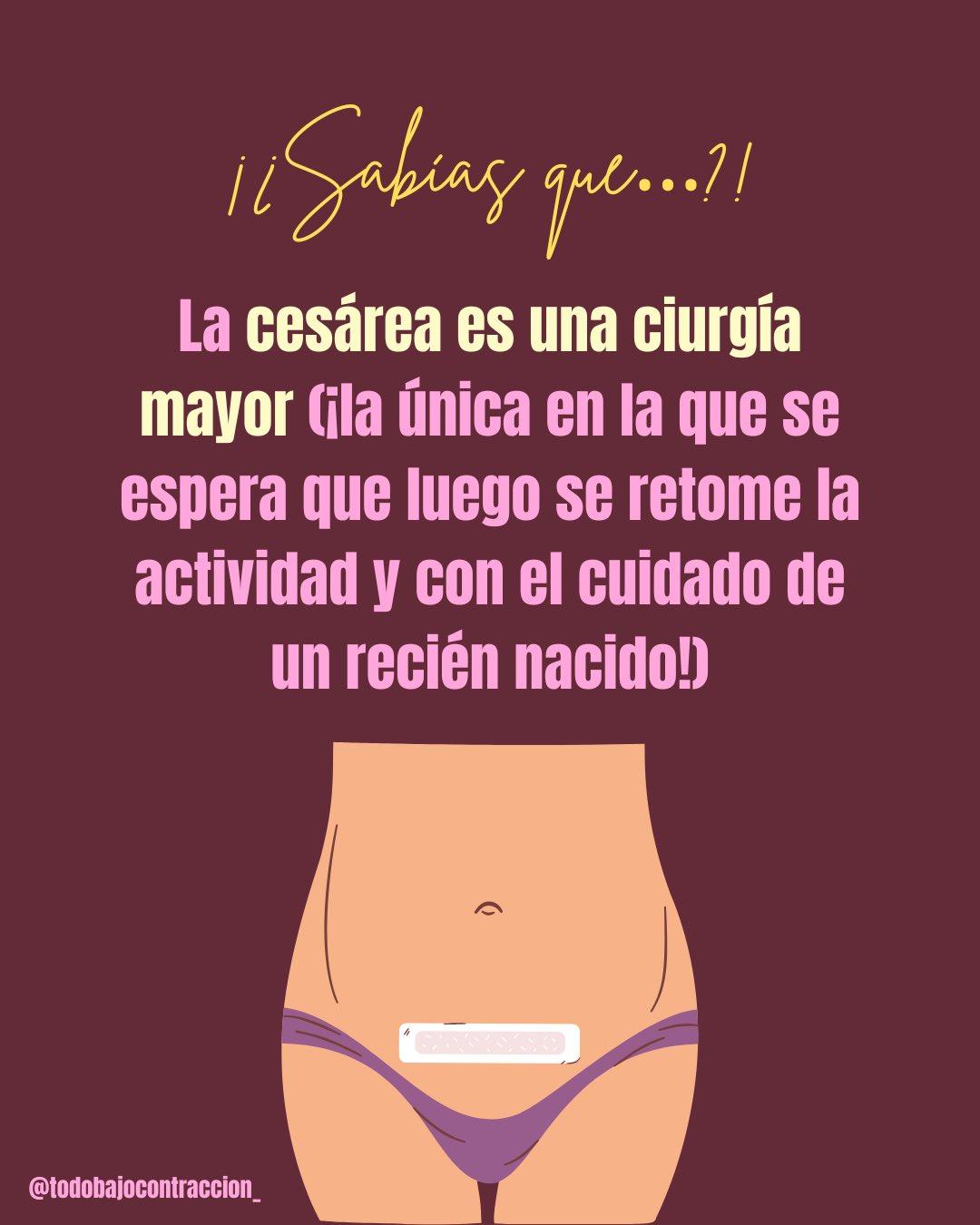 Carrusel ilustrado de Todo Bajo Contracción: Cesárea paso a paso