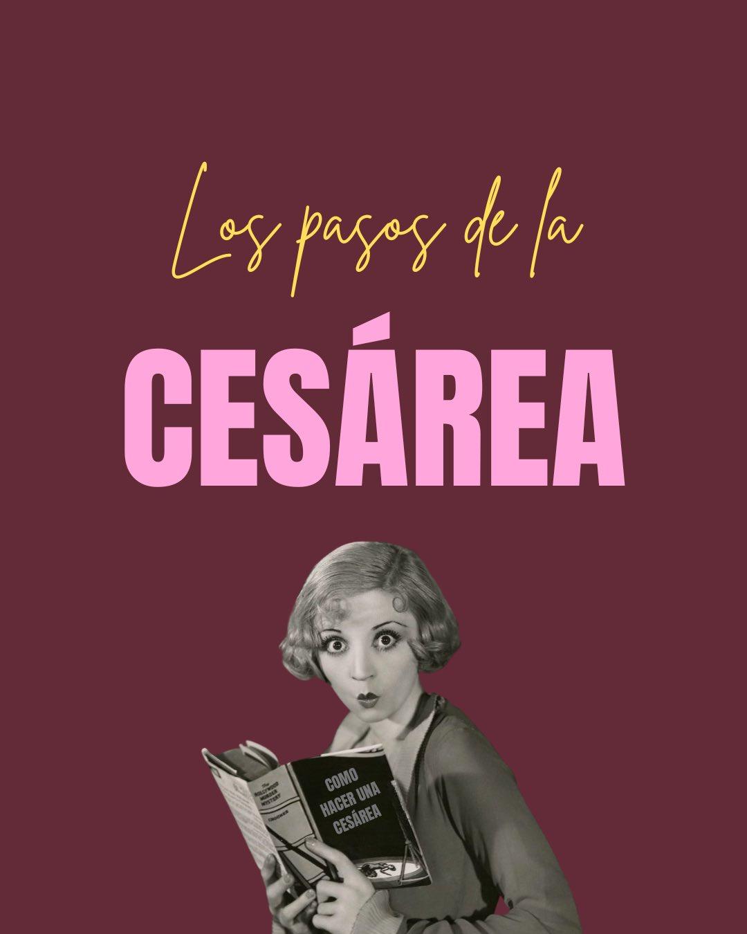 Carrusel ilustrado de Todo Bajo Contracción: Cesárea paso a paso