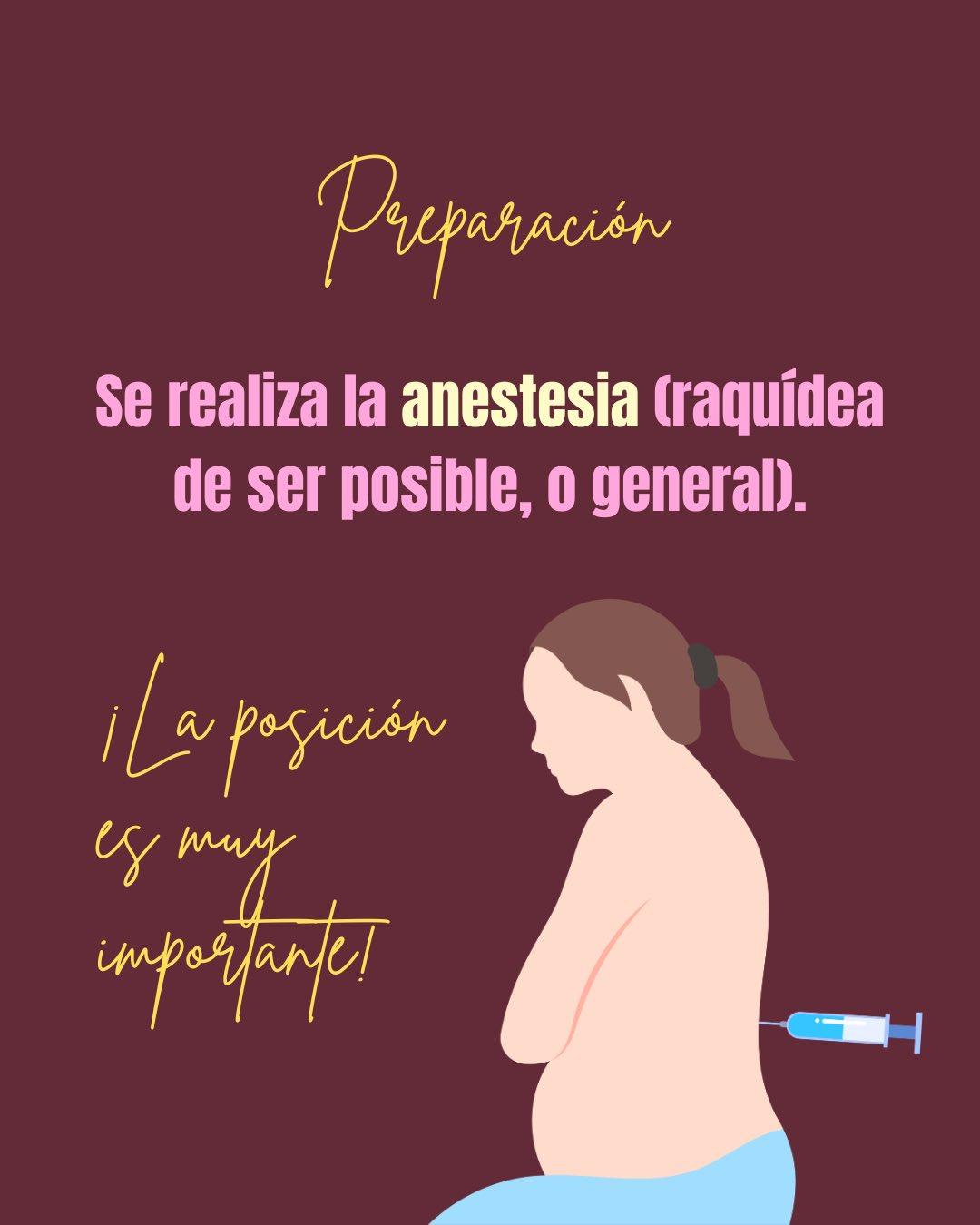Carrusel ilustrado de Todo Bajo Contracción: Cesárea paso a paso