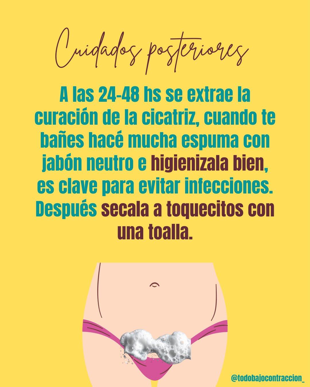 Carrusel ilustrado de Todo Bajo Contracción: Cesárea: recuperación y cuidados