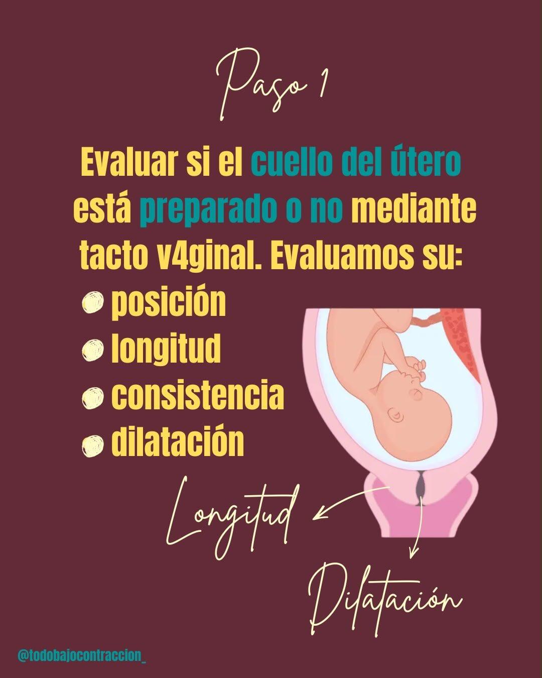 Carrusel ilustrado de Todo Bajo Contracción: Inducción del trabajo de parto