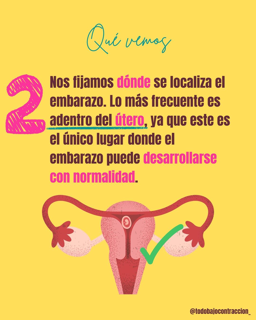 Carrusel ilustrado de Todo Bajo Contracción: La primera ecografía del embarazo