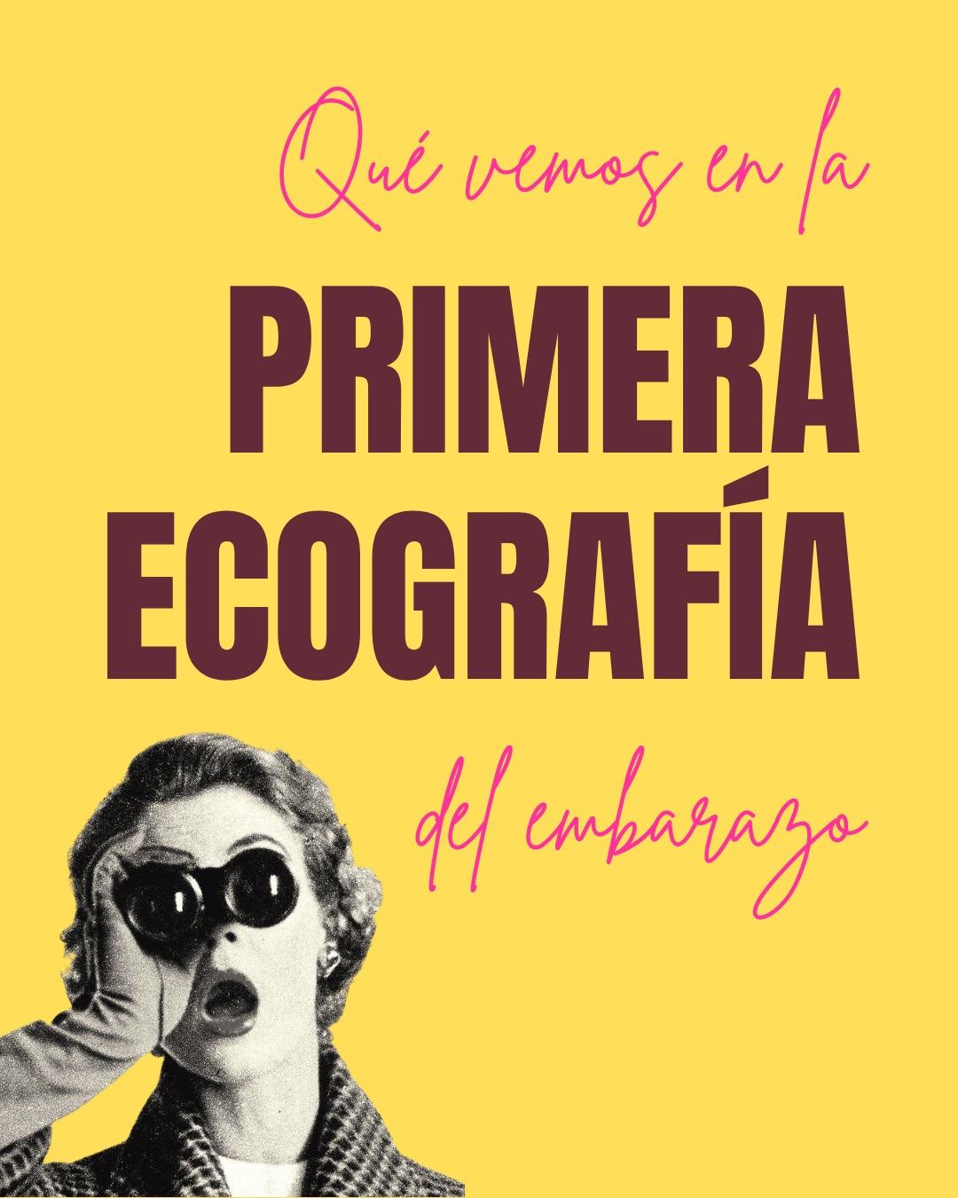 Carrusel ilustrado de Todo Bajo Contracción: La primera ecografía del embarazo
