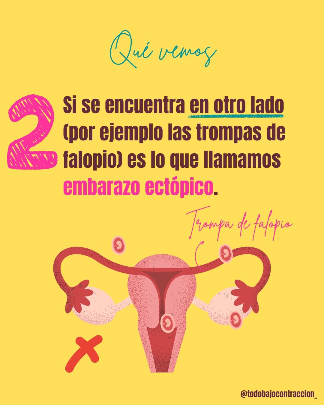 Carrusel ilustrado de Todo Bajo Contracción: La primera ecografía del embarazo