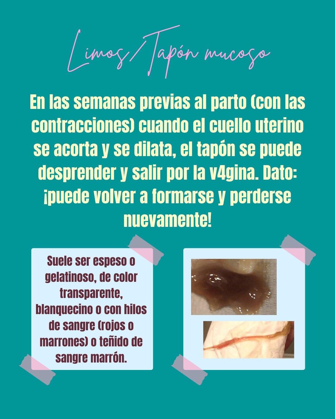 Carrusel ilustrado de Todo Bajo Contracción: Diccionario del embarazo y el posparto