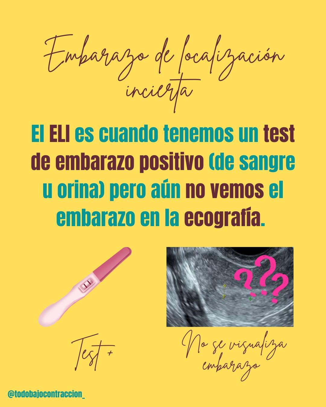 Carrusel ilustrado de Todo Bajo Contracción: Embarazo de localización incierta (ELI)