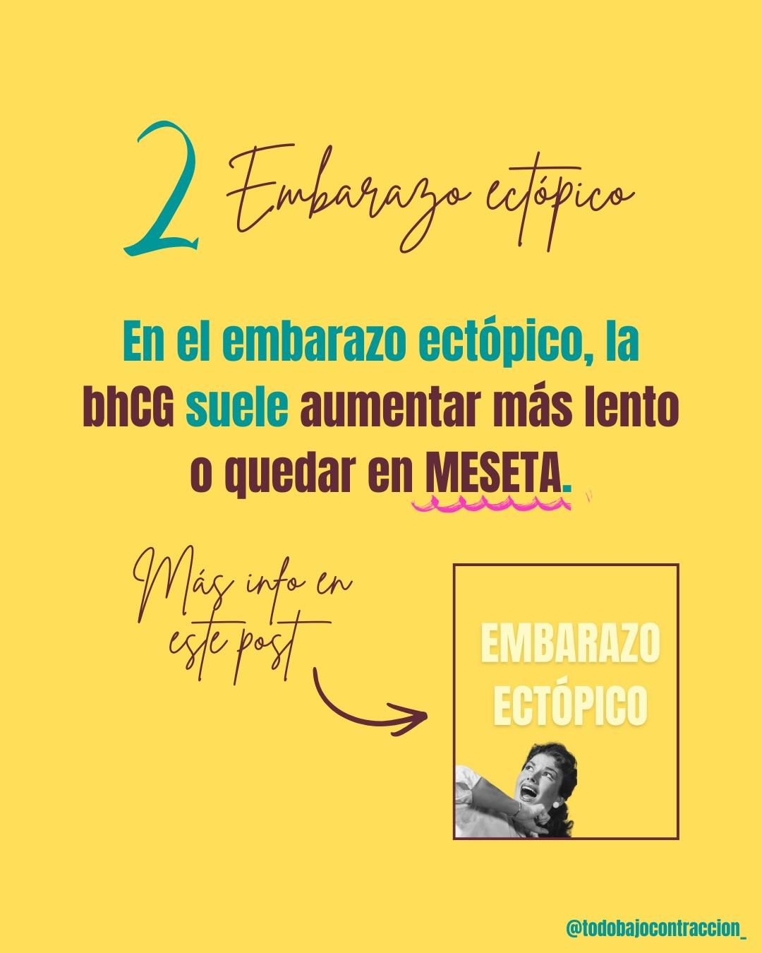 Carrusel ilustrado de Todo Bajo Contracción: Embarazo de localización incierta (ELI)