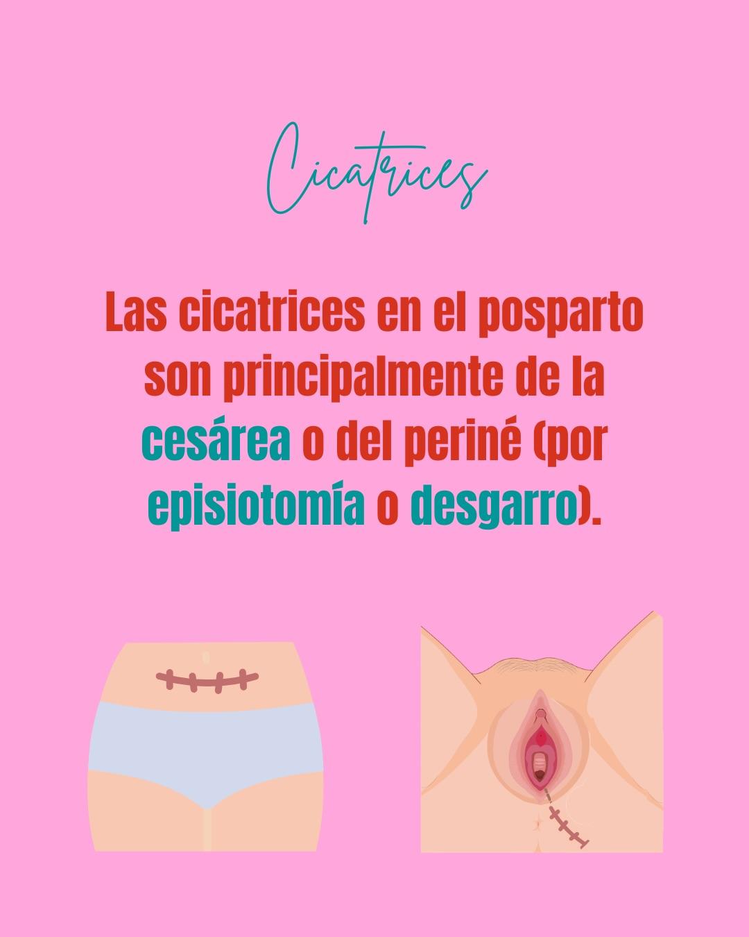 Carrusel ilustrado de Todo Bajo Contracción: Qué pasa en tu cuerpo en el posparto